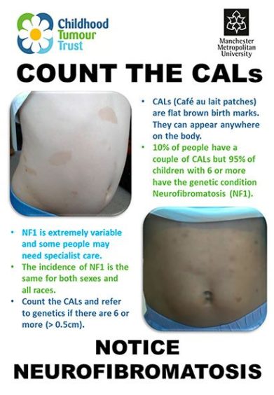 Count the CALs, notice neurofibromatosis